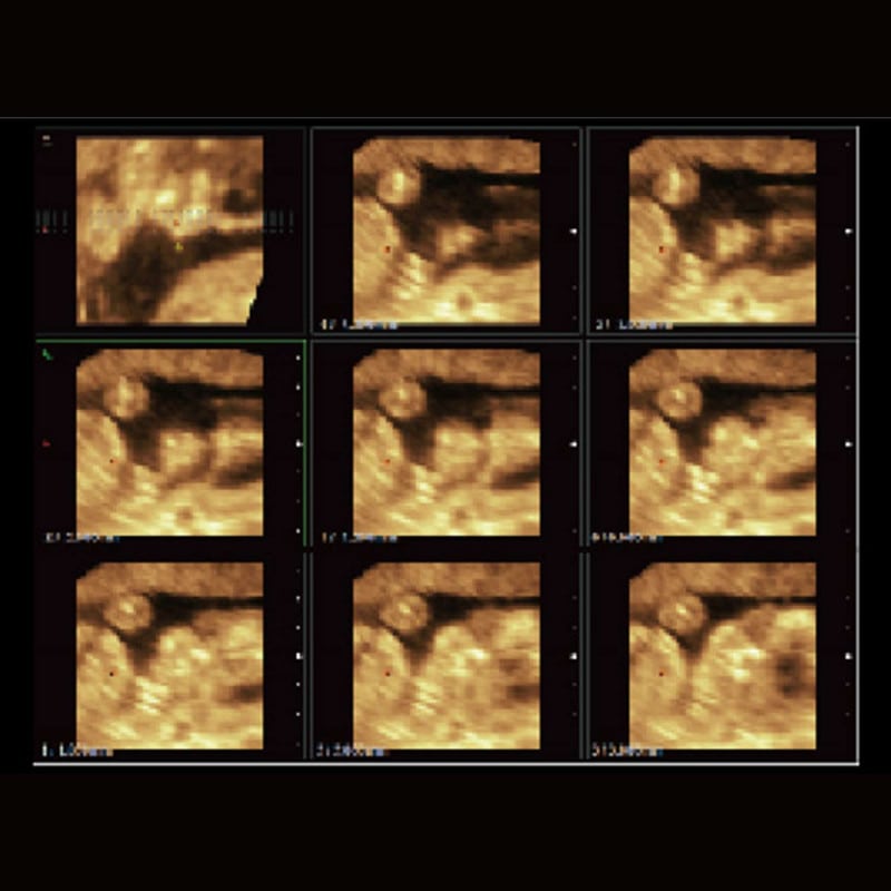 CBit 4 Ultrasound System Medvana UK