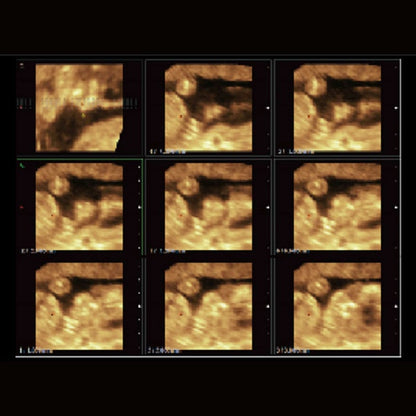 CBit 4 Ultrasound System Medvana UK