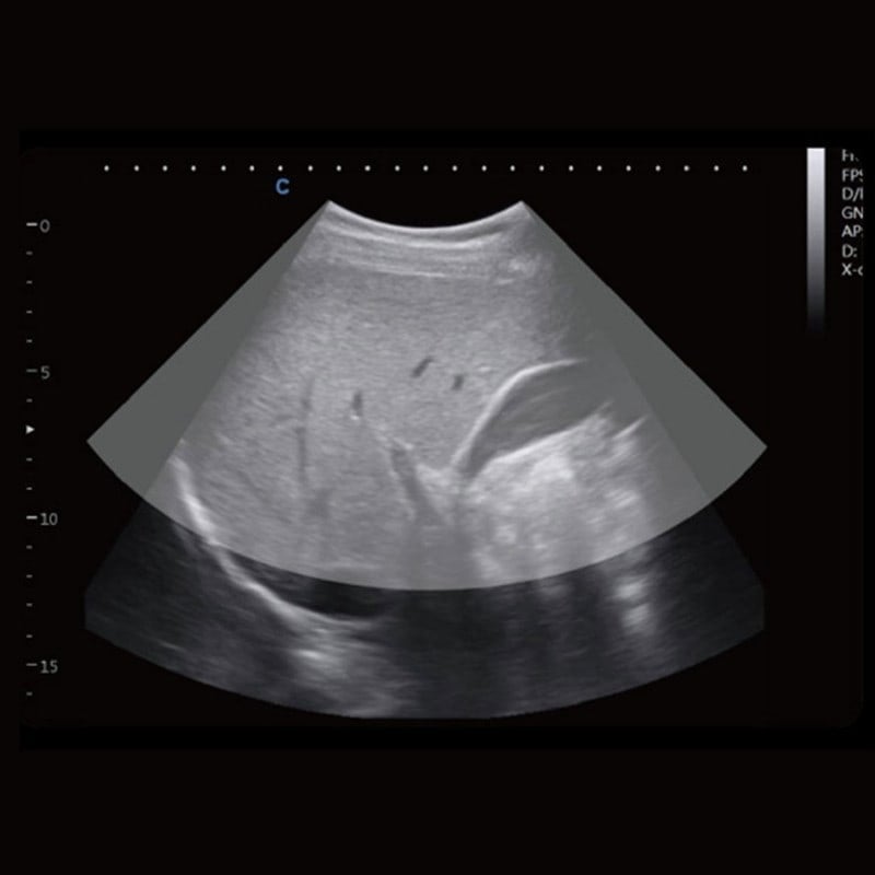 CBit 4 Ultrasound System Medvana UK