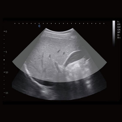 CBit 4 Ultrasound System Medvana UK