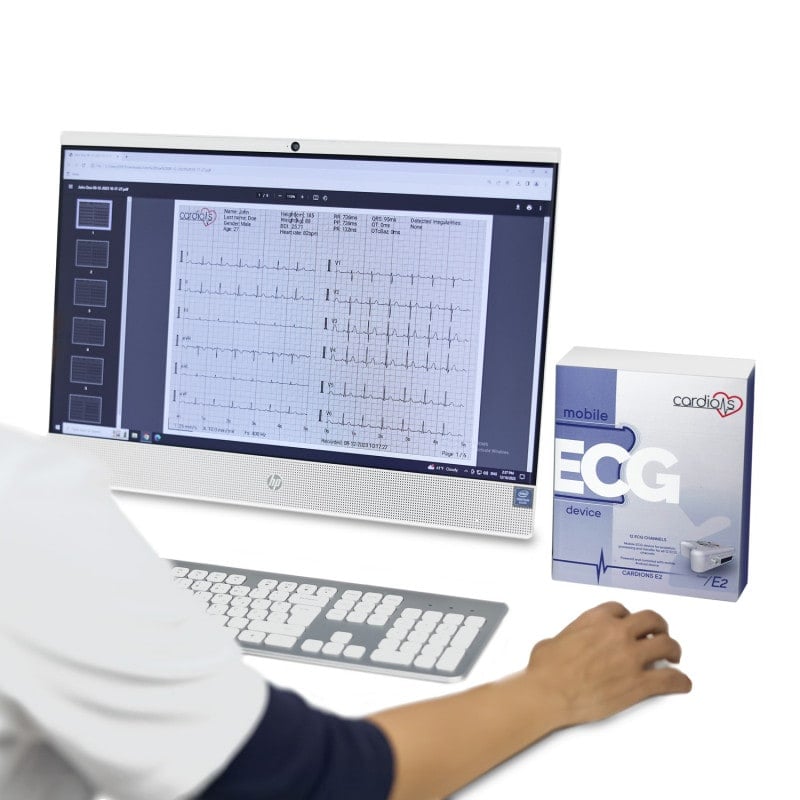 CardioNS E2 with banana plug cable | without tablet Medvana UK