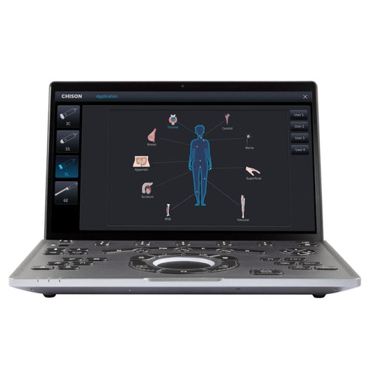 CHISON SonoAir 30 with trolley Medvana UK