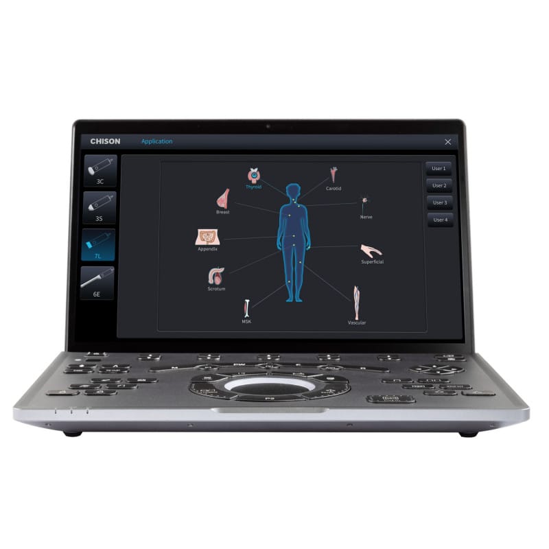 CHISON SonoAir 30 without trolley Medvana UK