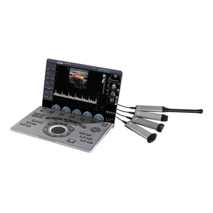 CHISON SonoAir 30 with trolley Medvana UK