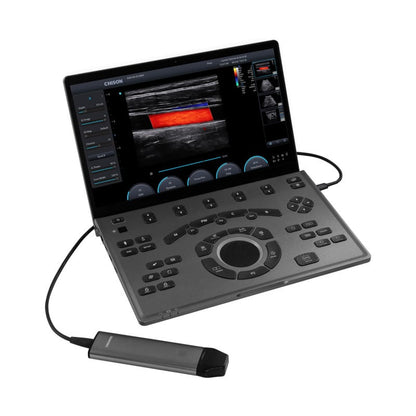 CHISON SonoAir 30 with trolley Medvana UK