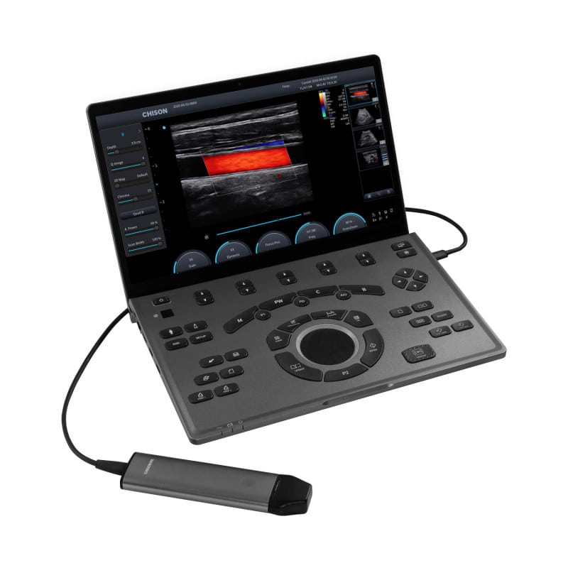 CHISON SonoAir 30 without trolley Medvana UK