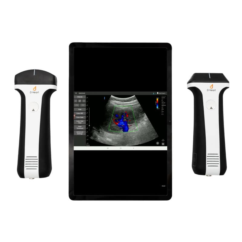 D-Heart Linear + Convex Scanner Medvana UK