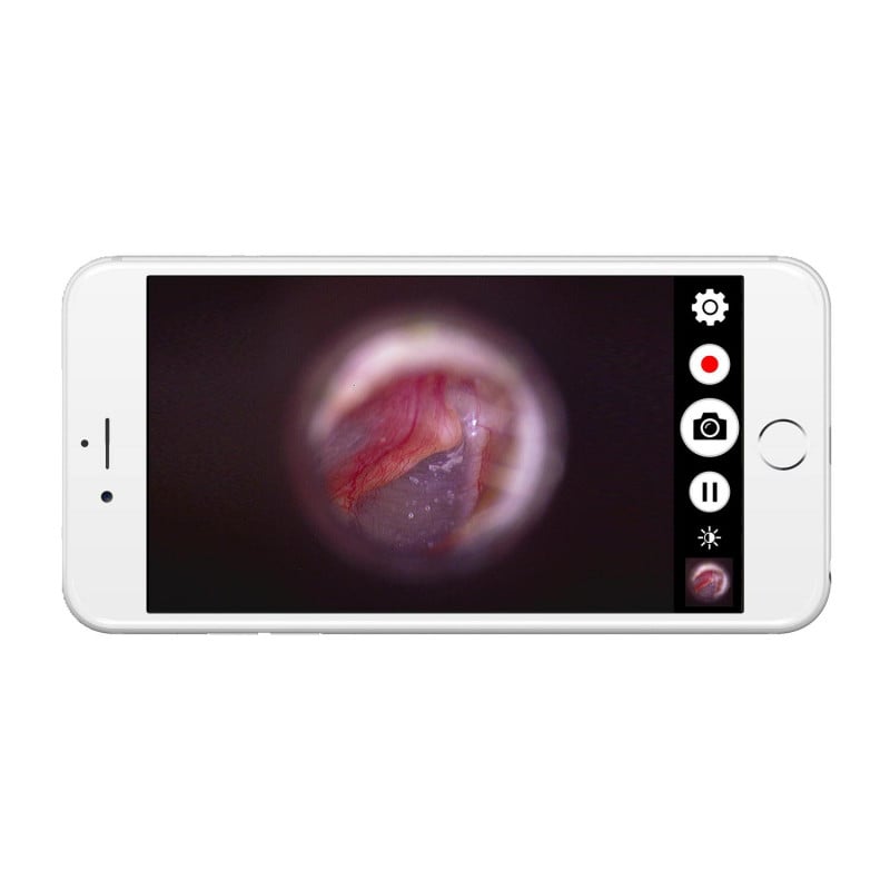 DE1270 HD Mobile Wireless Endoscope Camera Medvana UK