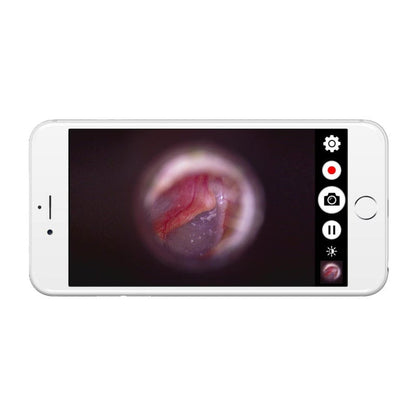 DE1270 HD Mobile Wireless Endoscope Camera Medvana UK