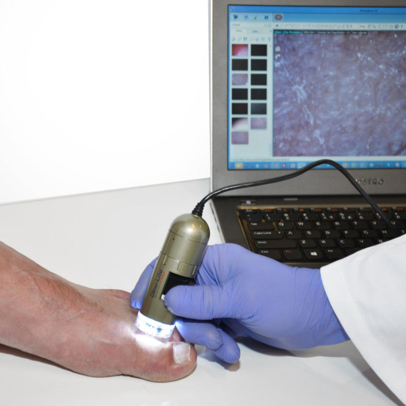 Dino-Lite PodoScope Medvana UK