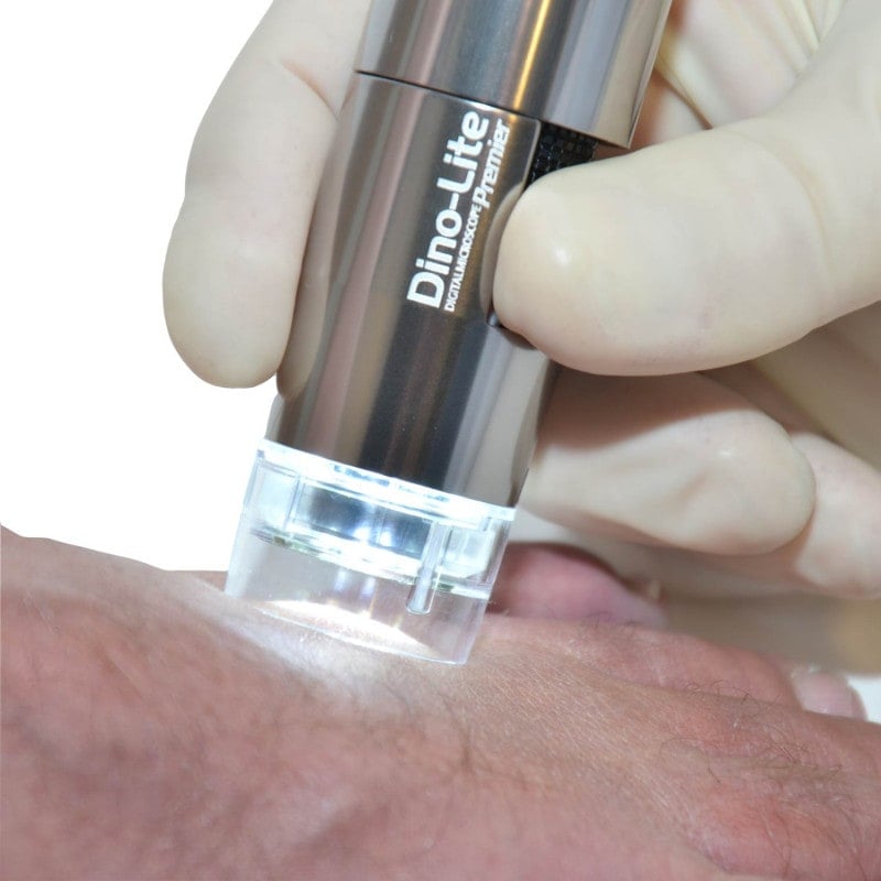 Dino-Lite PodoScope Medvana UK