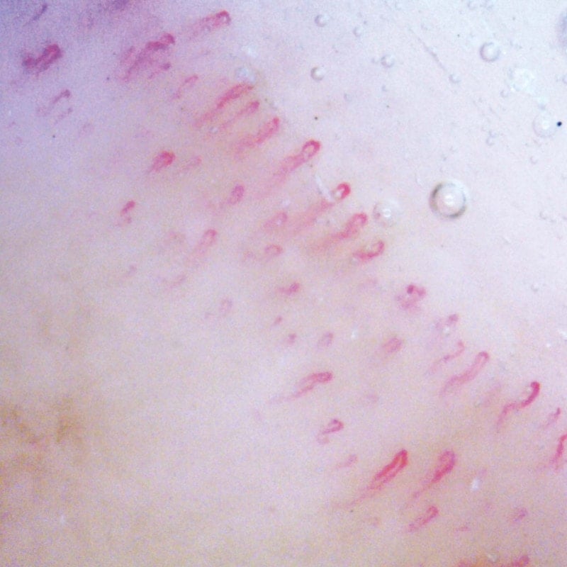 Dino-Lite CapillaryScope 200 Pro Wireless Medvana UK