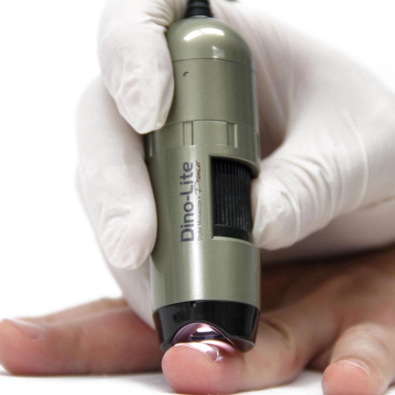 Dino-Lite CapillaryScope 200 Pro Wireless Medvana UK