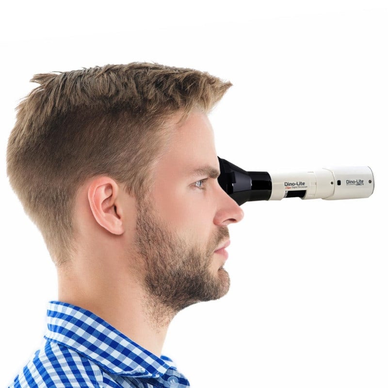 Dino-Lite IriScope Wireless Medvana UK