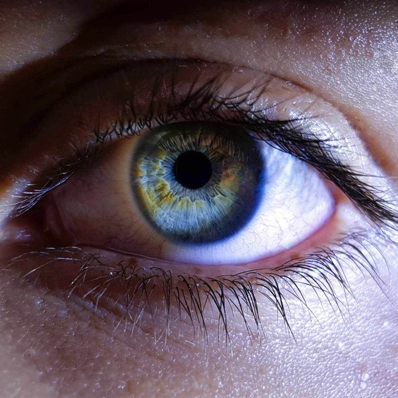 Dino-Lite IriScope Wireless Medvana UK