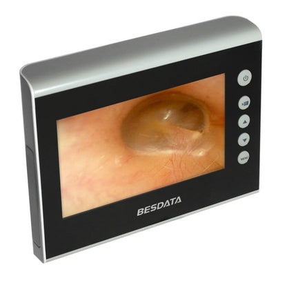 Bronchoscopy Monitor Medvana UK