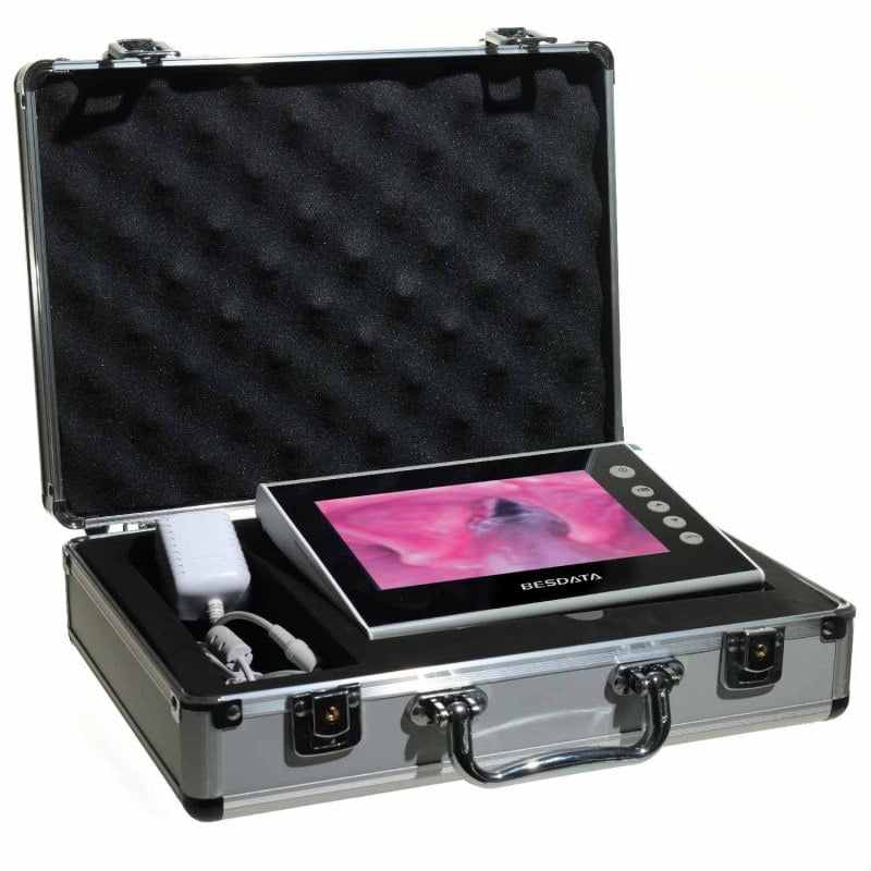 Bronchoscopy Monitor Medvana UK