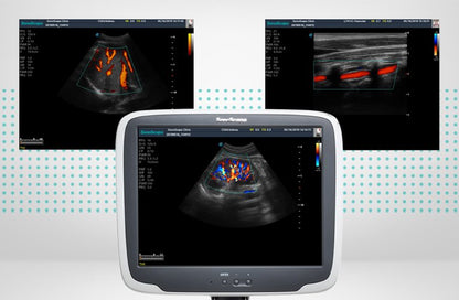 SonoScape S11 Plus ultrasound system battery included Medvana UK