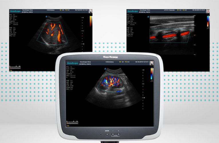 SonoScape S11 Plus ultrasound system without battery Medvana UK