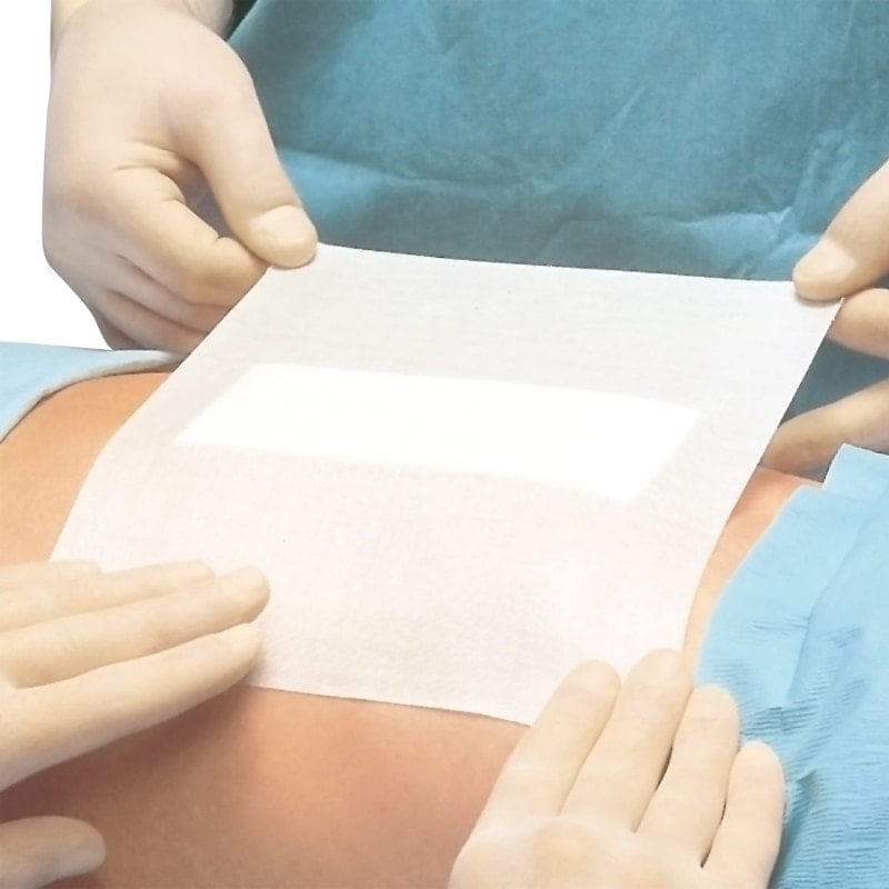 Fixomull 15 cm Medvana UK