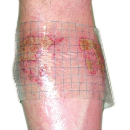 HydroTac transparent Gel Dressing 20 cm x 20 cm Medvana UK