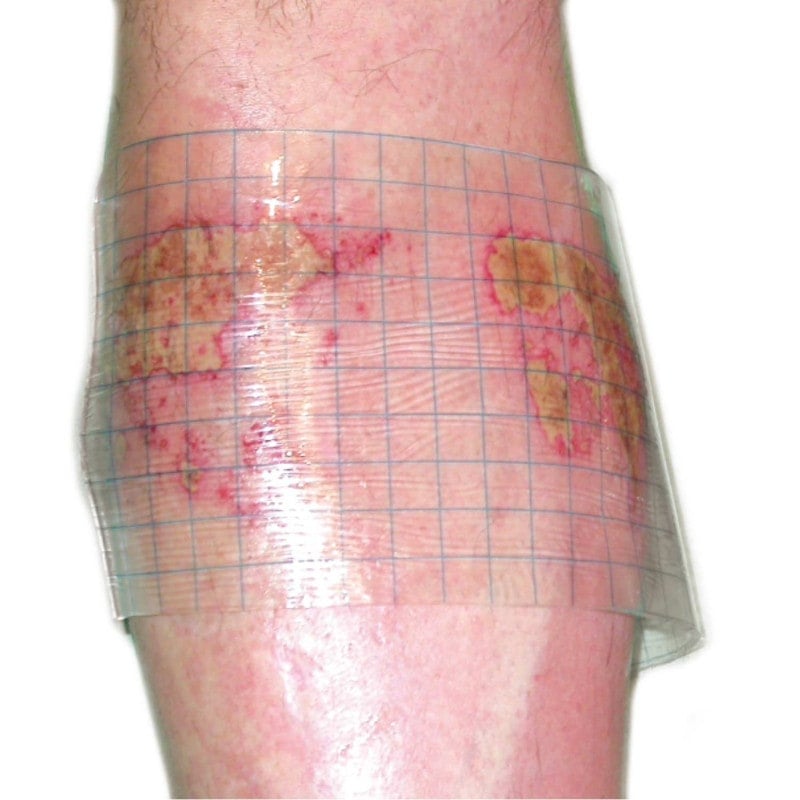 HydroTac transparent Gel Dressing 10 cm x 10 cm Medvana UK