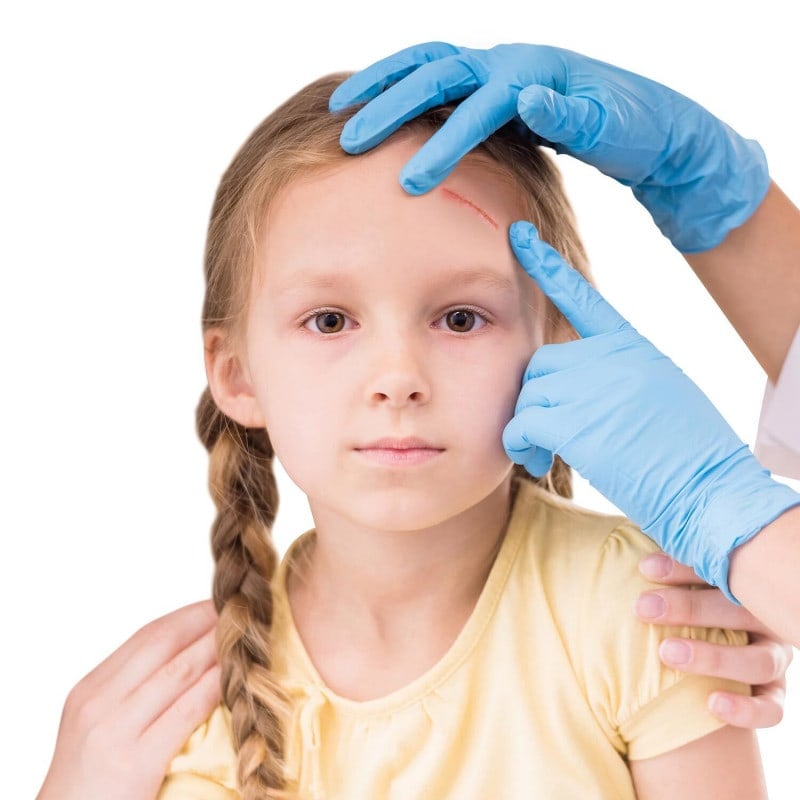 TRUglue® Wound Adhesive 5 PCS Medvana UK