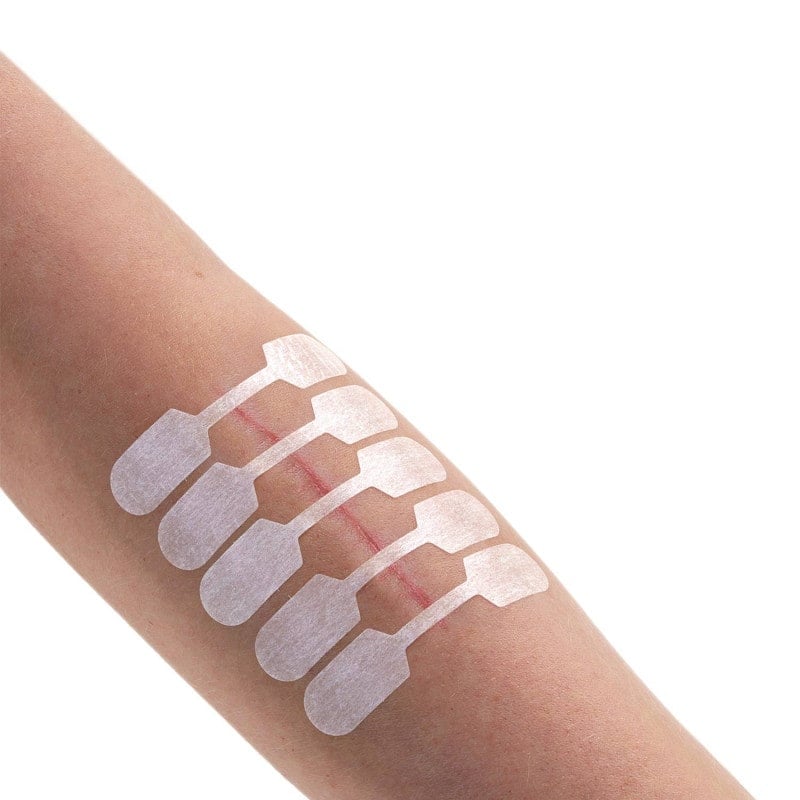 Sterigrap Wound Closure Strips Dumbbell, 32 x 8 mm (10 PCS) Medvana UK