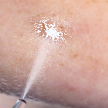 Cryoalfa SUPER Contact | in case Medvana UK