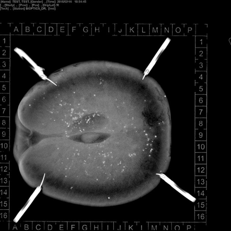 KLINITRAY™ Mammary Plates R | Large Medvana UK