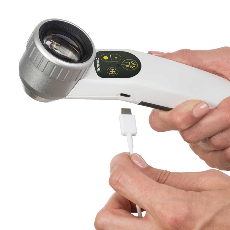 Visiomed Luminis 2 Dermatoscope
