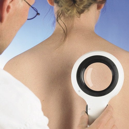 DermLite Lumio, Magnifying Light Dermatoscope LED Medvana UK