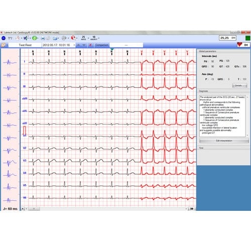EC-12R PC Resting ECG Medvana UK