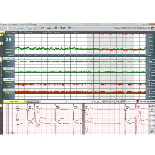 EC-3H Holter ECG System Medvana UK