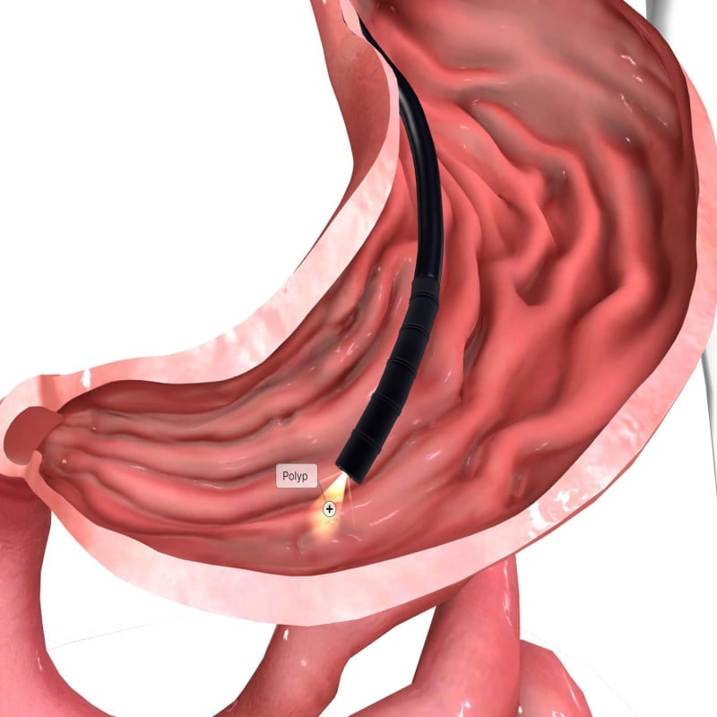 HD-500 Video Gastroscope EG-500L Medvana UK