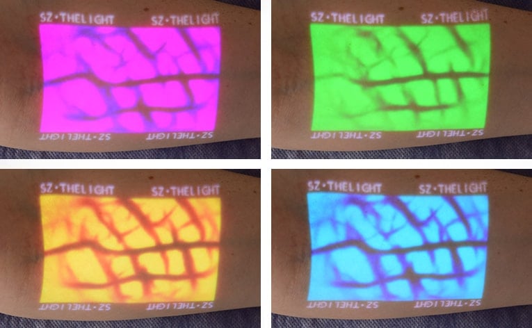 Enmind VV-100 Vein Viewer Medvana UK