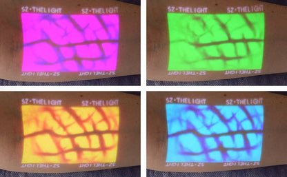 Enmind VV-100 Vein Viewer Medvana UK