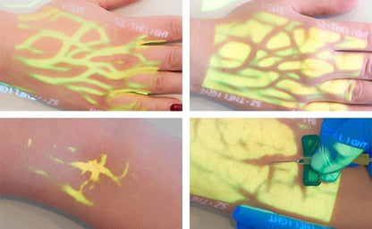 Enmind VV-100 Vein Viewer Medvana UK