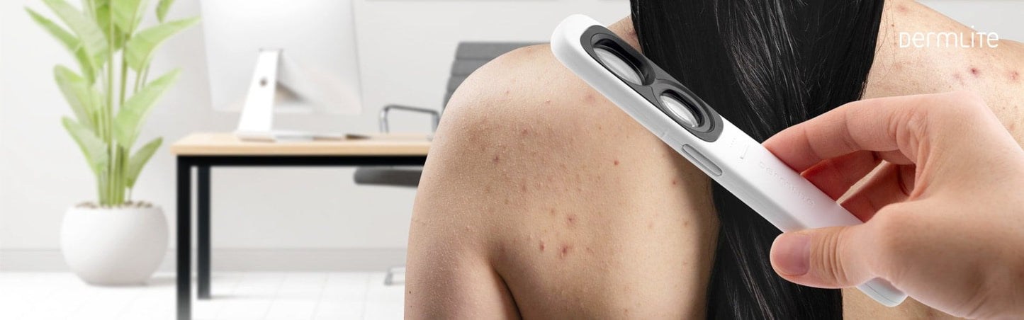 DermLite GL Medvana UK