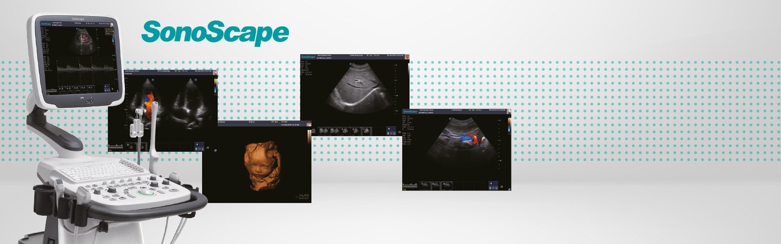 SonoScape S11 Plus ultrasound system battery included Medvana UK