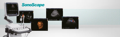 SonoScape S11 Plus ultrasound system battery included Medvana UK