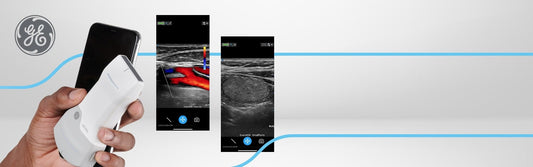 Vscan Air™ CL Ultrasound System