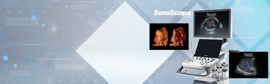 Sonoscape P15 Ultrasound Machine with battery Medvana UK