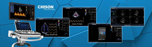 XBit 80 Color Doppler Ultrasound System with battery