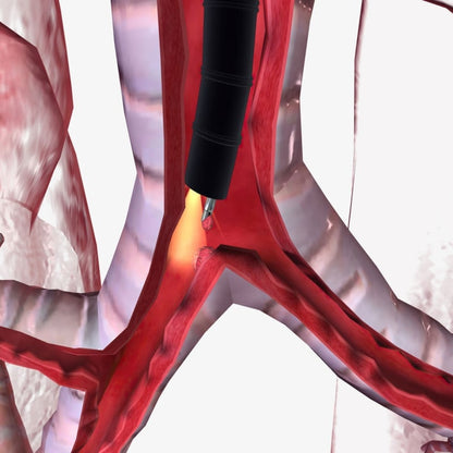 HD-500 Video Bronchoscope Medvana UK