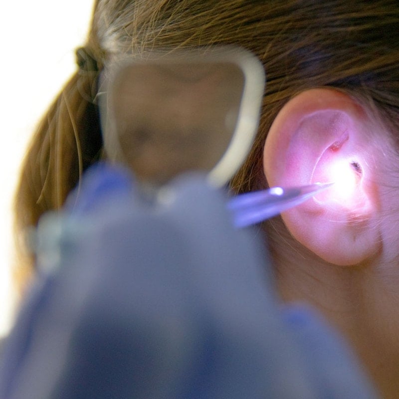 Bionix Illuminating Ear Curettes Medvana UK