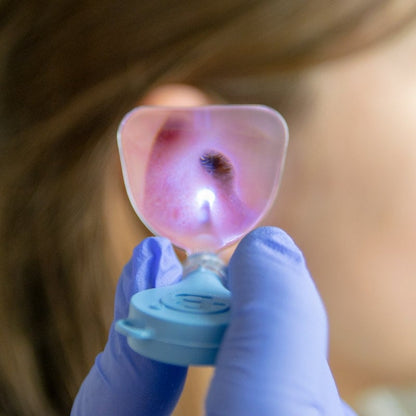 Bionix Illuminating Ear Curettes Medvana UK