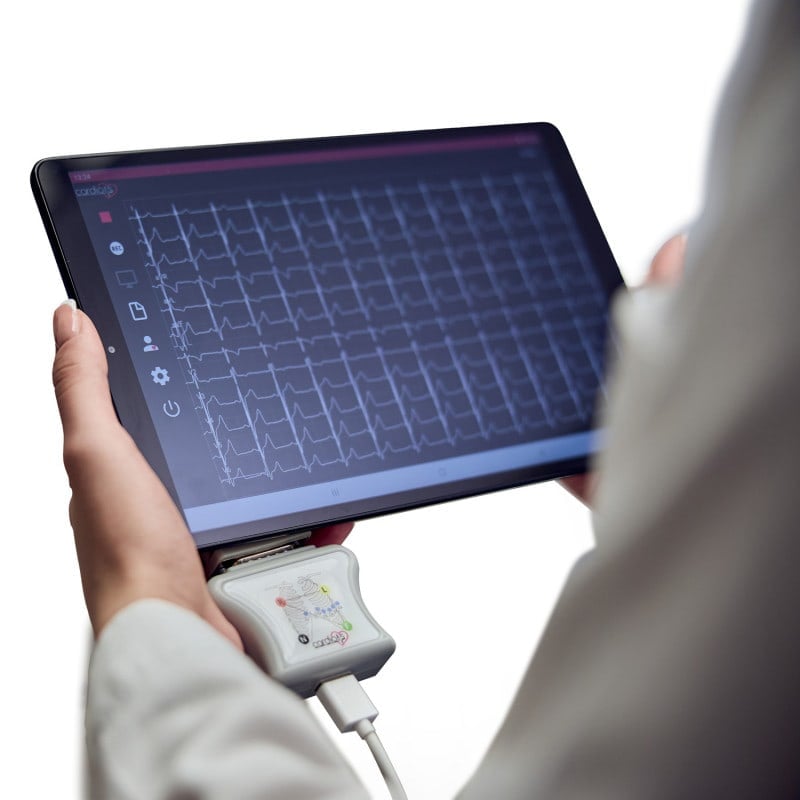 CardioNS E2 with banana plug cable | without tablet Medvana UK