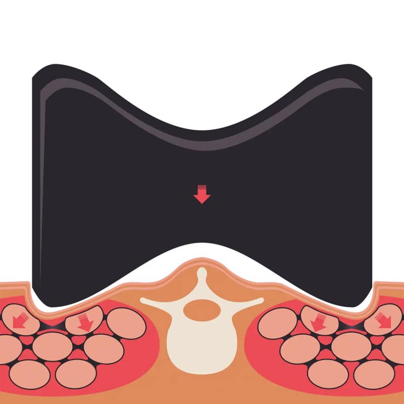 TMX® PARA BACK TRIGGER Medvana UK