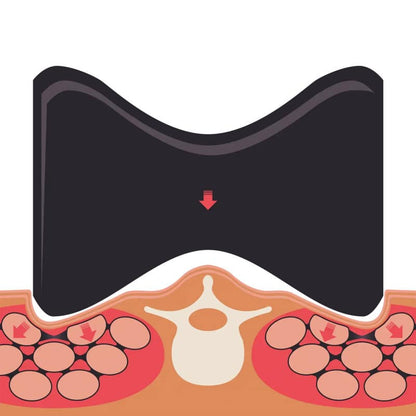 TMX® PARA BACK TRIGGER Medvana UK